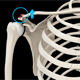 Acromioclavicular joint (AC joint) dislocation